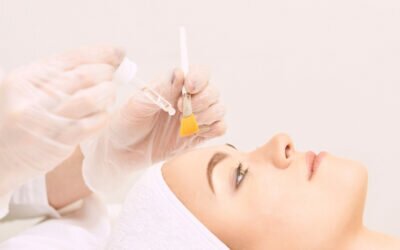 Home Benefits of a Chemical Peel: Discovering Healthier Skin